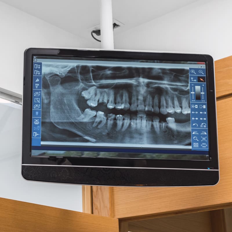 Dental Technology, Hanover Dentist